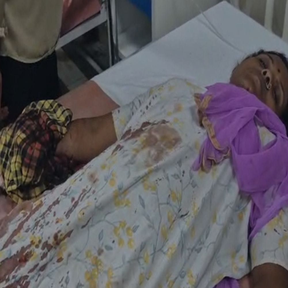 शादी पार्टी के दूसरे जमकर चले लाठी-डंडे और हथियार:बिलासपुर में पड़ोसियों के गाली देने से विवाद, हमले में 4 की हालत गंभीर;महिला रायपुर रेफर