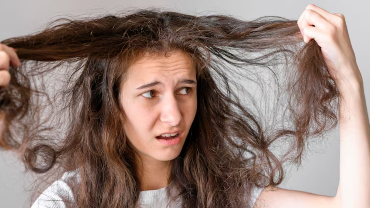 झड़ते बालों से हैं परेशान? गंजेपन से बचने के लिए आज़माए किचन का ये मसाला, कंट्रोल होगा हेयर फॉल