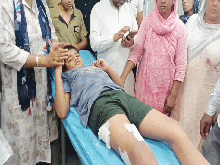 गुरदासपुर में पुलिसकर्मी के पिटबुल ने पिता-पुत्र को नोचा:बाजार में शॉपिंग करने आया था परिवार, बच्चे को 6 जगह आए गहरे जख्म, झाड़ू-डंडों की मदद से लोगों ने बमुश्किल छुड़ाई जान