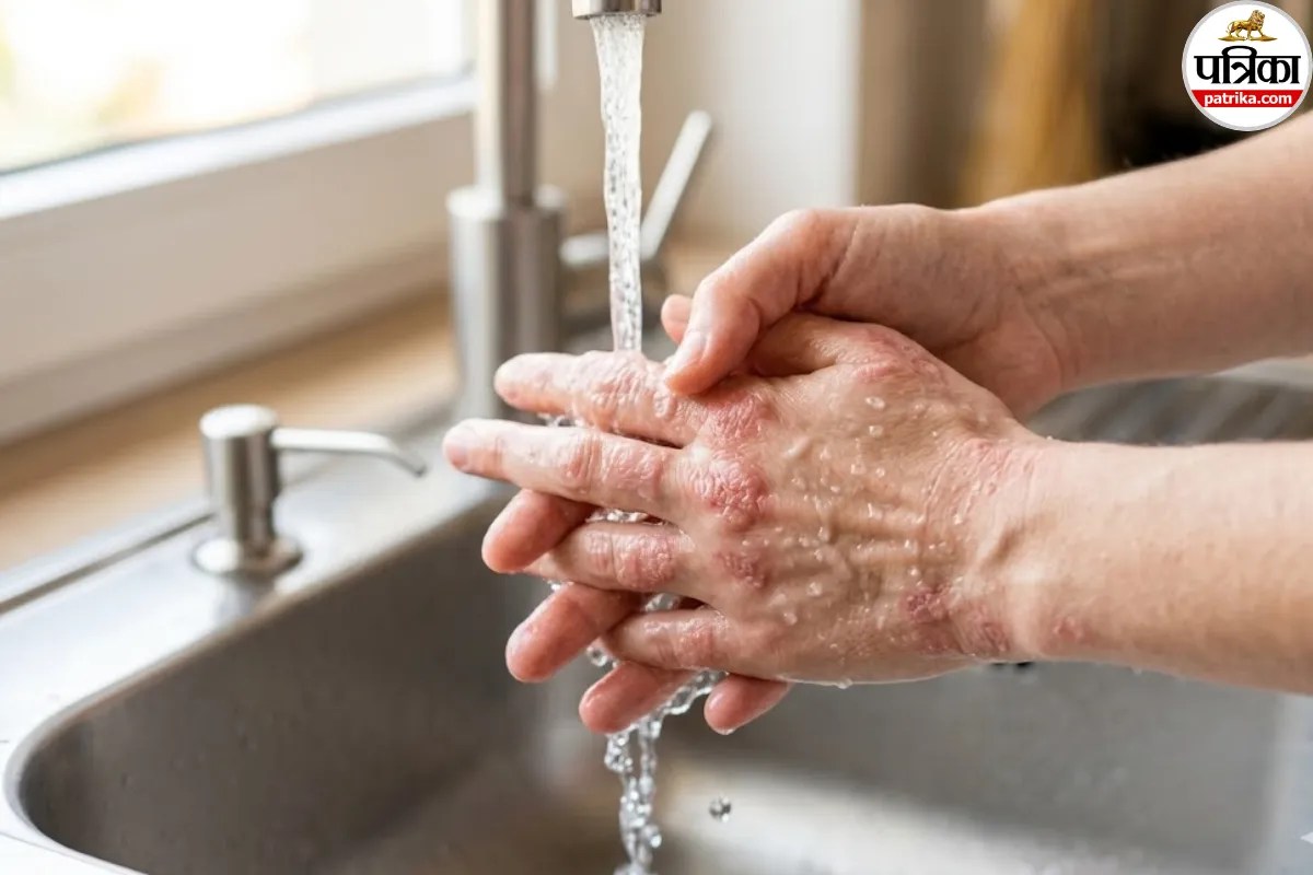Water Allergy: सबसे दुर्लभ बिमारियों में से एक पानी से एलर्जी! अभी जानें क्या होती है Aquagenic Urticaria