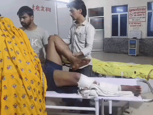 शादी का कार्ड देने जा रहे युवकों पर हमला:अज्ञात बदमाशों ने सड़क पर जमकर मारपीट की;एक की हालत गंभीर