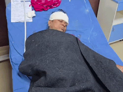 बाइक सवार दंपति को मिनी ट्रक ने मारी टक्कर:दोनों घायल,शादी से घर लौट रहे थे,कोटा बारां हाईवे पर हुआ हादसा