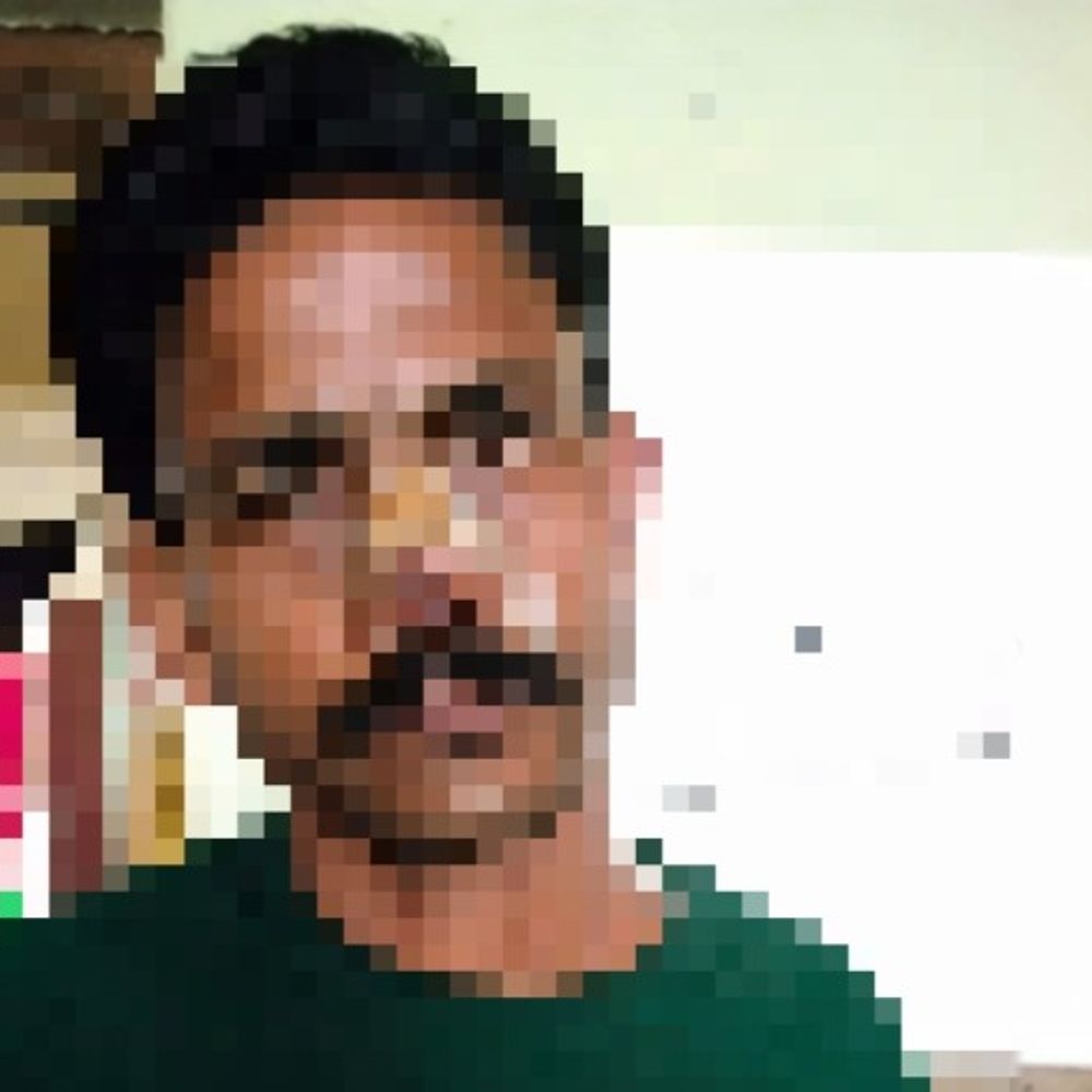 दरभंगा में नाबालिग लड़की से छेड़खानी:विरोध करने पर चाचा पर कुल्हाड़ी से हमला, नाक पर 7 टांके लगे