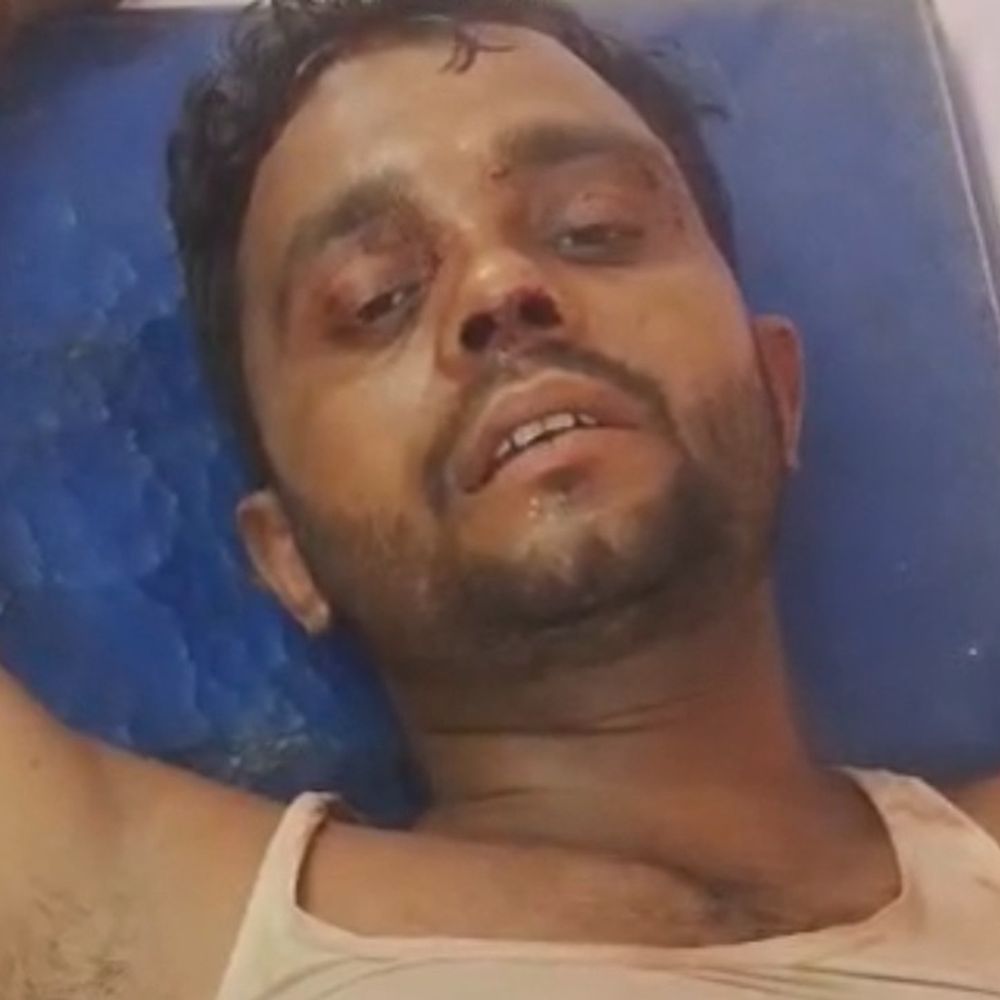 दरभंगा में अपराधियों ने युवक को मारी गोली:बुलेट लगते ही जमीन पर गिरा, हालत नाजुक; भीड़ जुटने पर हमलावर मौके से फरार