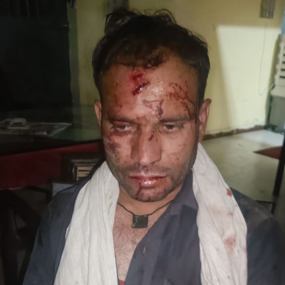 खिराला गांव में घर में घुसकर युवक पर हमला:कोर्ट केस में राजीनामे का बना रहे थे दबाव; 4 पर एफआईआर