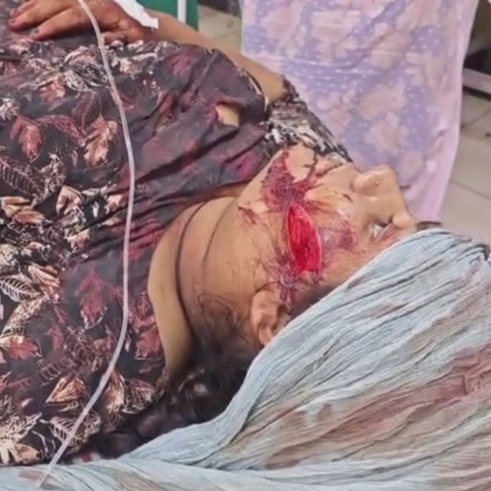 जान तो बच गई, लेकिन पिता से खौफजदा है बेटी:प्रेमी से बात करने पर पिता ने किया था छुरे से हमला, गम्भीर बनी हुई है हालत
