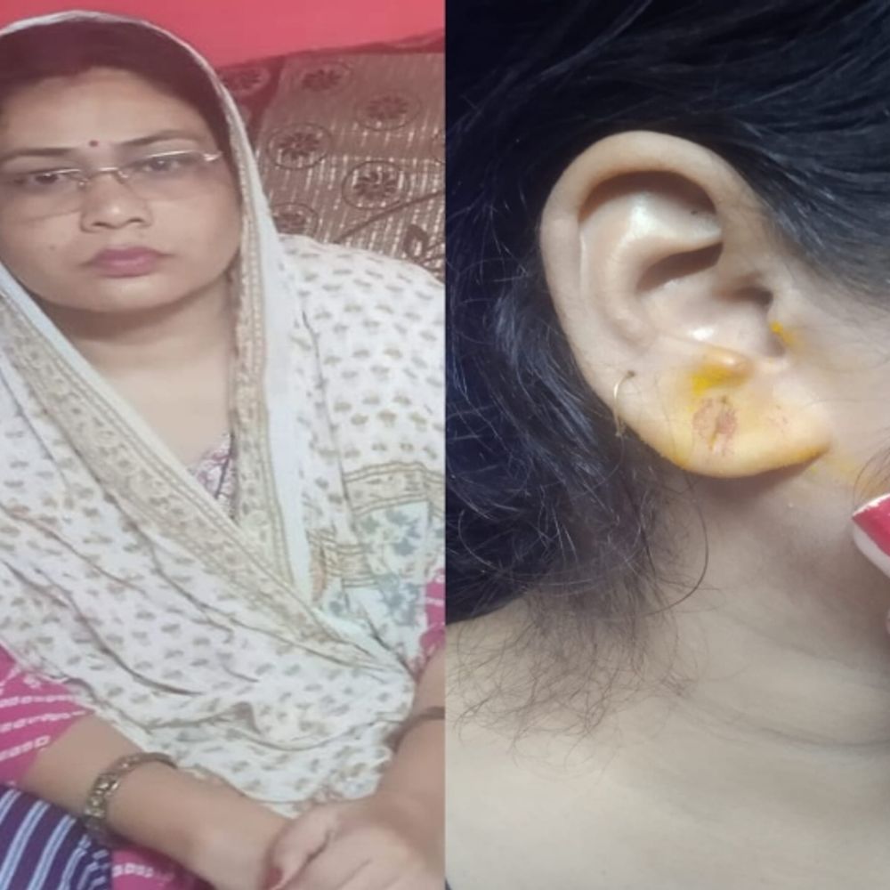 ग्वालियर में हाईवे से दंपती से गहने लूटे:शादी में जा रहे थे, बदमाशों ने पति पर अड़ाया कट्‌टा, पत्नी से लूटा मंगलसूत्र-झुमके