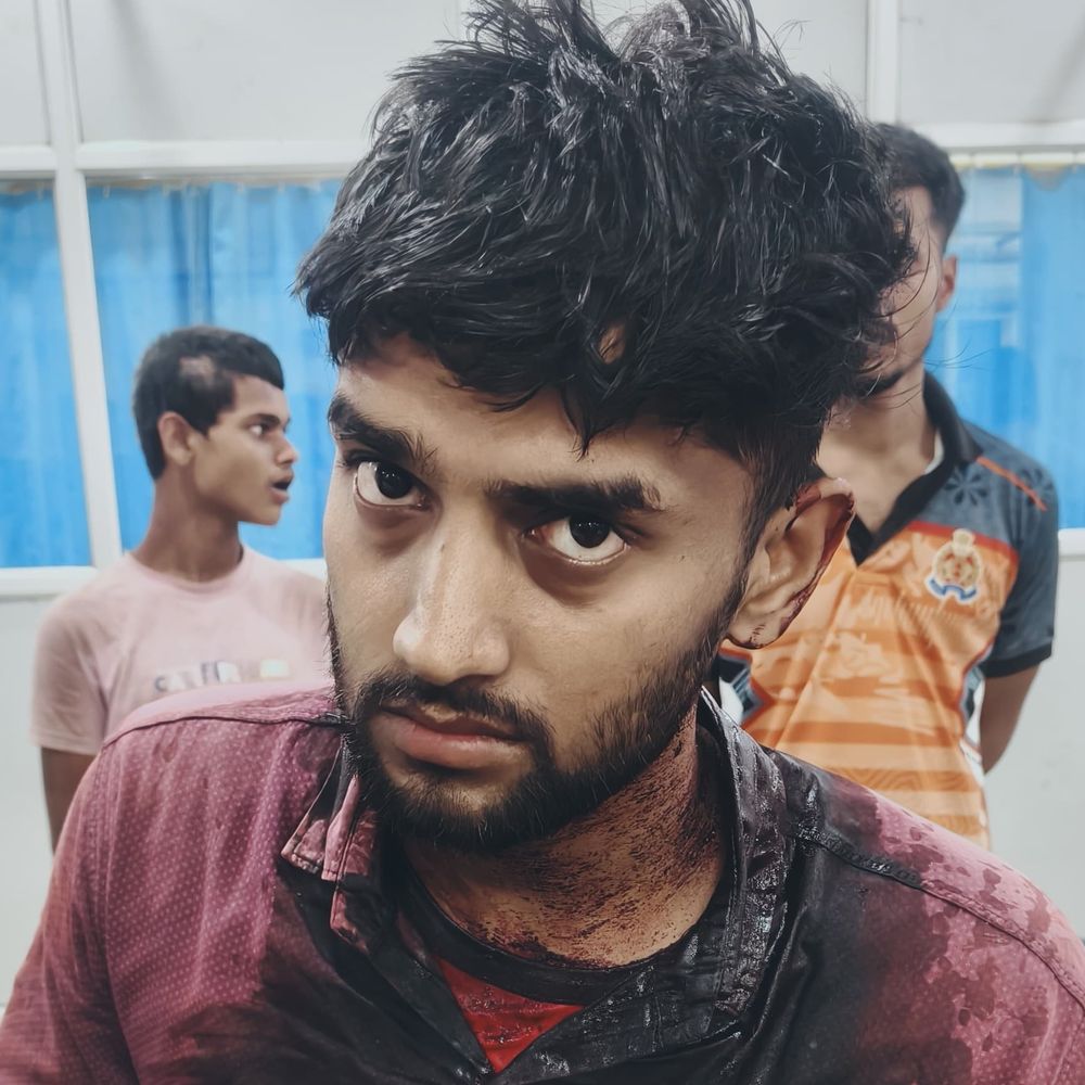 गाजीपुर में युवक को सिर में मारी गोली:हालत गंभीर, 3 हमलावरों ने घर के बाहर किया हमला