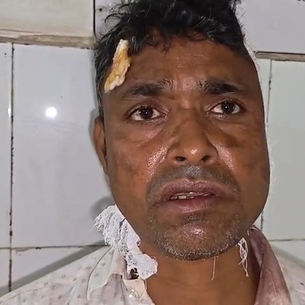 जमुई में बुजुर्ग समेत तीन पर कुल्हाड़ी से हमला:महिला से छेड़छाड़ की शिकायत करना पड़ा भारी, गंभीर हालत में एक घायल एम्स रेफर