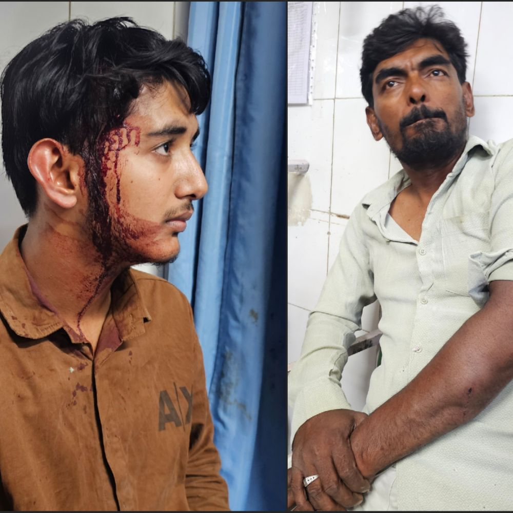 पिता-पुत्र पर हमला, नाबालिग के सिर पर रॉड से वार:मंदसौर में ईरानी चाय की दुकान पर घूरने की बात पर शुरू हुआ विवाद