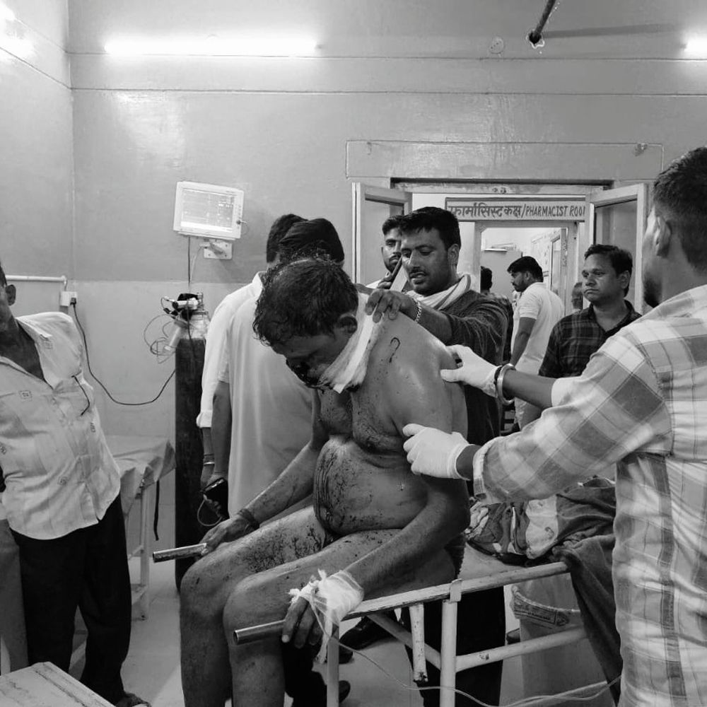 रिटायर्ड फौजी को घर में गोली लगी, जबड़ा उड़ा:राइफल की सफाई करते समय फायरिंग, हालत गंभीर होने पर कानपुर रेफर