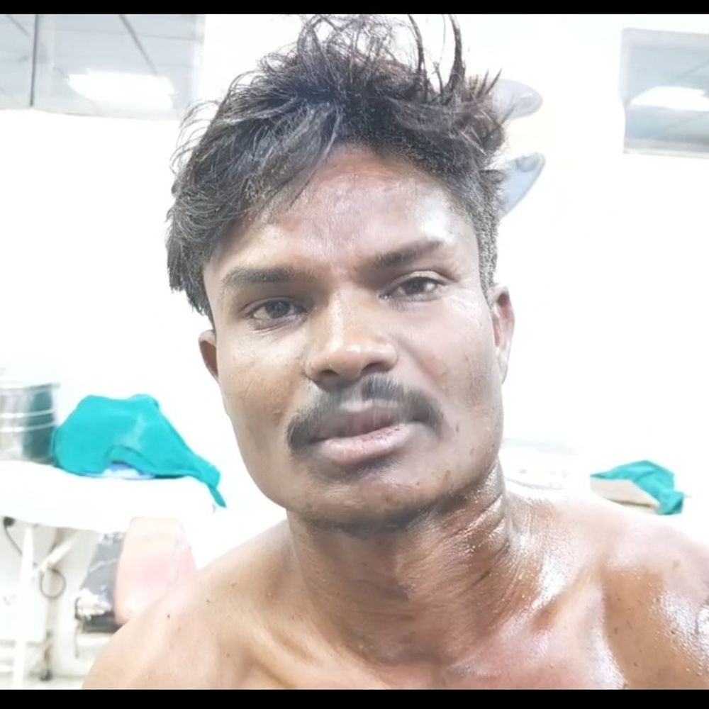 पत्नी ने पति को जलते भूसे में धकेला:झालावाड़ में युवक गंभीर झुलसा, पुलिस ने बयान दर्ज किए