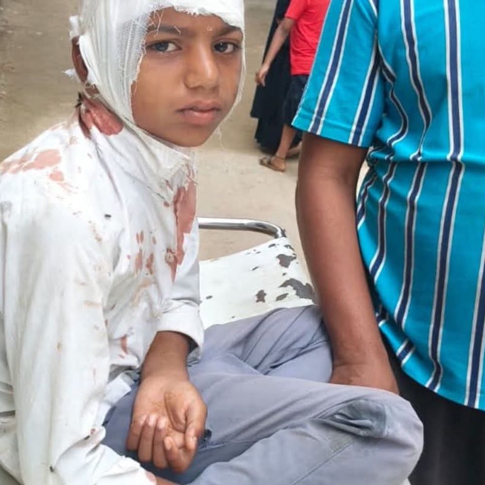 स्कूल जा रहे छात्र को बोलेरो ने मारी ठोकर:प्राथमिक उपचार के बाद सीवान रेफर किया गया