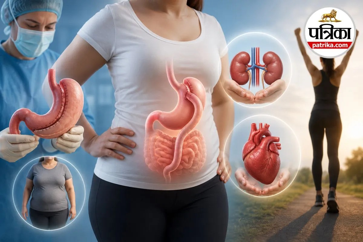 Bariatric Surgery: क्या है बैरिएट्रिक सर्जरी! वजन कम करने के साथ Kidney Failure और Heart Attack का खतरा कर सकती है कम- नई स्टडी