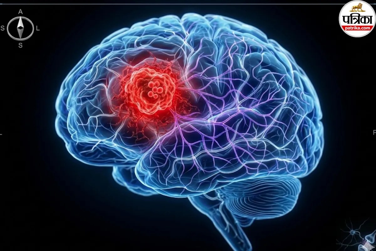 Brain Tumor and Testosterone: टेस्टोस्टेरोन हार्मोन पुरुषों में ब्रेनट्यूमर के विकास को रोक सकता है- रिसर्च