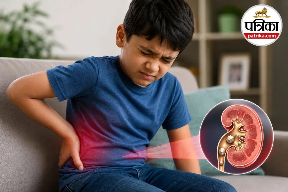 Kidney Stone Causes: अब बच्चों में भी होने लगी किडनी स्टोन की बीमारी! डॉक्टरों ने बताया कौन-सी रोज की आदतें बन रही वजह