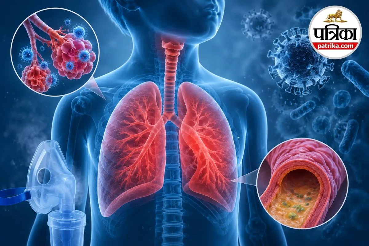 Respiratory Infections: दुनिया में हर दिन 1,800 बच्चों की सांस संबंधी संक्रमण से मौत, जानिए निमोनिया के शुरुआती लक्षण और बचाव