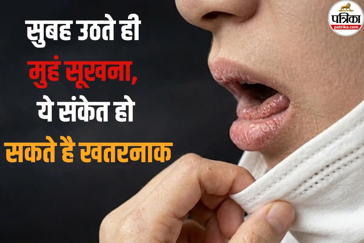 सोकर उठते ही सूख जाता है मुंह! रिसर्च में सामने आई ये चौंकाने वाली वजह, कहीं आपको भी तो नहीं ये बीमारी