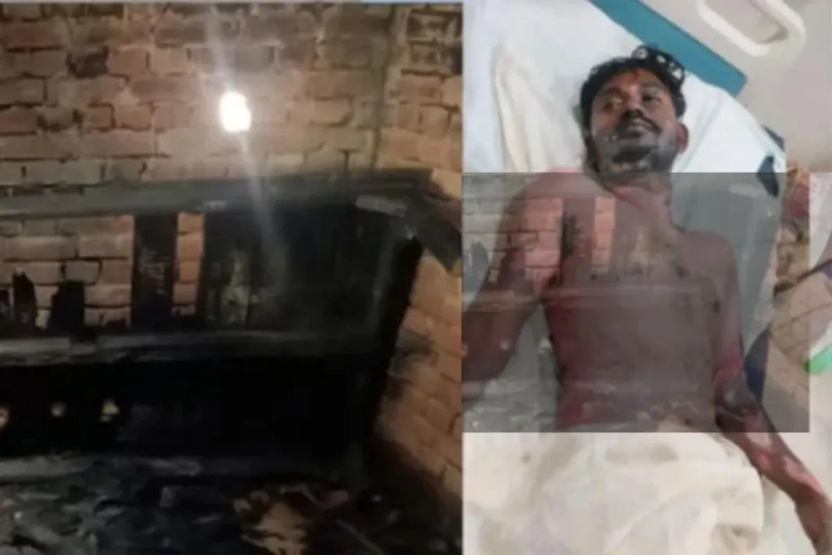 प्रेमी को जिंदा जला कर प्रेमिका फरार…दो बच्चों की मां के साथ लिव इन में था पीड़ित, क्षेत्र में हड़कंप