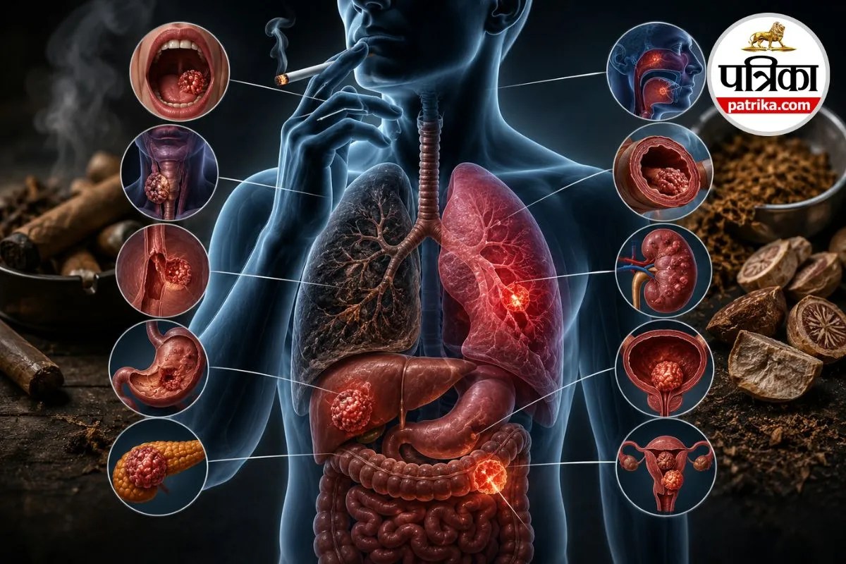 World No Tobacco Day 2026: तंबाकू से सिर्फ फेफड़े नहीं, होते हैं 30 प्रकार के कैंसर, युवाओं को ज्यादा खतरा