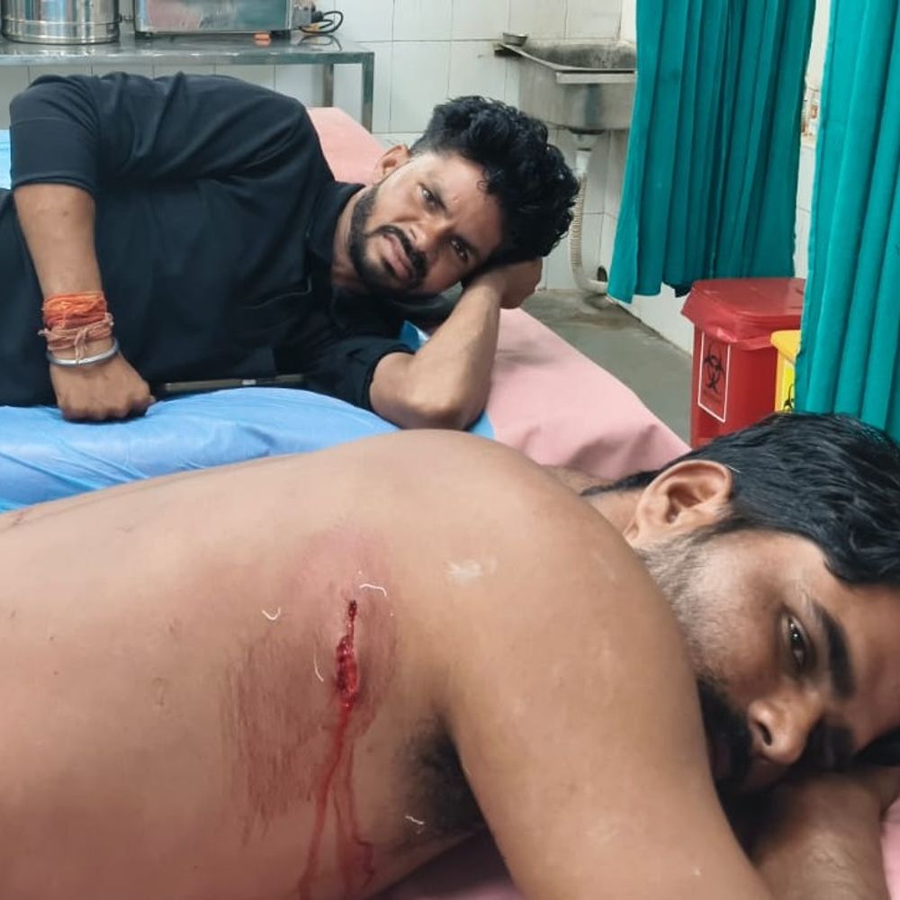 शिवपुरी में खेत पर जंगली सूअर का हमला:दो भाई घायल; झाड़ियों से किया था अचानक वार