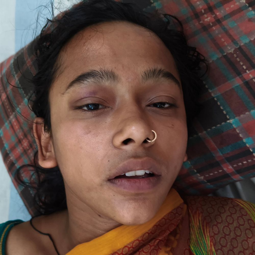समस्तीपुर में महिला दुकानदार से मारपीट:700 रुपए बकाया मांगने पर पड़ोसी ने किया हमला; शरीर के कई हिस्सों में लगी चोट