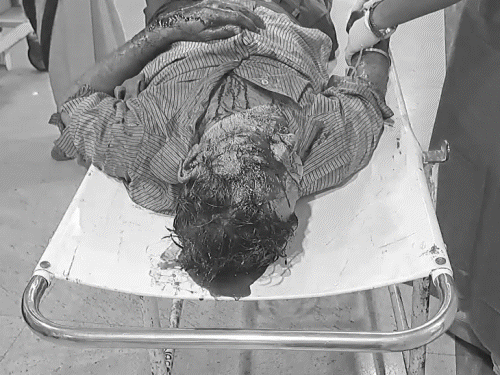 पिता को ‘भूत’ समझ बेटे ने धारदार हथियार से मारा:जमशेदपुर में देर रात घर में मचा हड़कंप, खून से लथपथ मिले, लोगों ने पहुंचाया अस्पताल