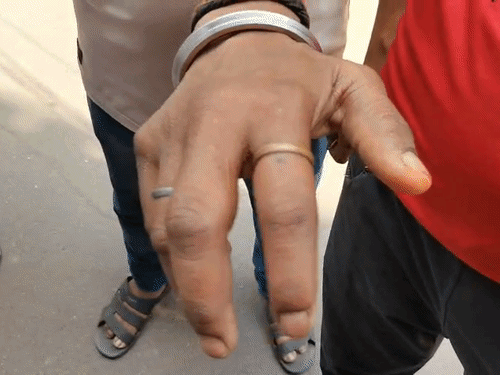 कानपुर में रीलबाज दरोगा ने दी युवक को थर्ड डिग्री:चोरी के आरोप में 40 सेकेंड में जड़े 15 तमाचे, हाथों में सूजा फंसाकर जूतों से दबाया