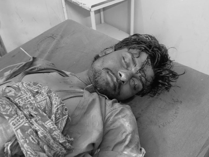 खगड़िया में दुकानदार पर जानलेवा हमला:दुकान से घर लौटते समय रास्ते में दो लोगों ने रोका; सिर, पेट और पीठ पर चाकू से वार किए