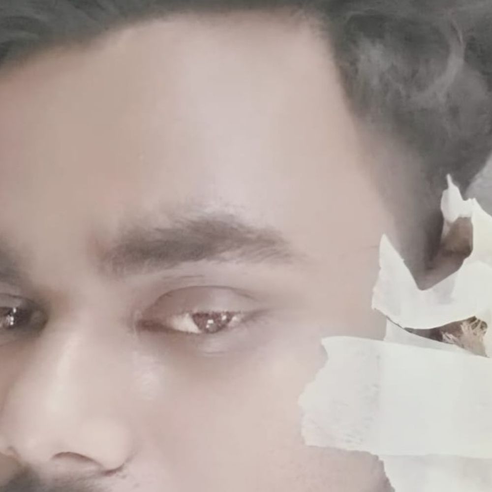 बहादुरगढ़ में ब्याज के लिए ऑटो चालक पर हमला:अस्पताल तक पीछा कर मारपीट, कान काटा, मामले में FIR दर्ज, 6 धाराओं में केस,