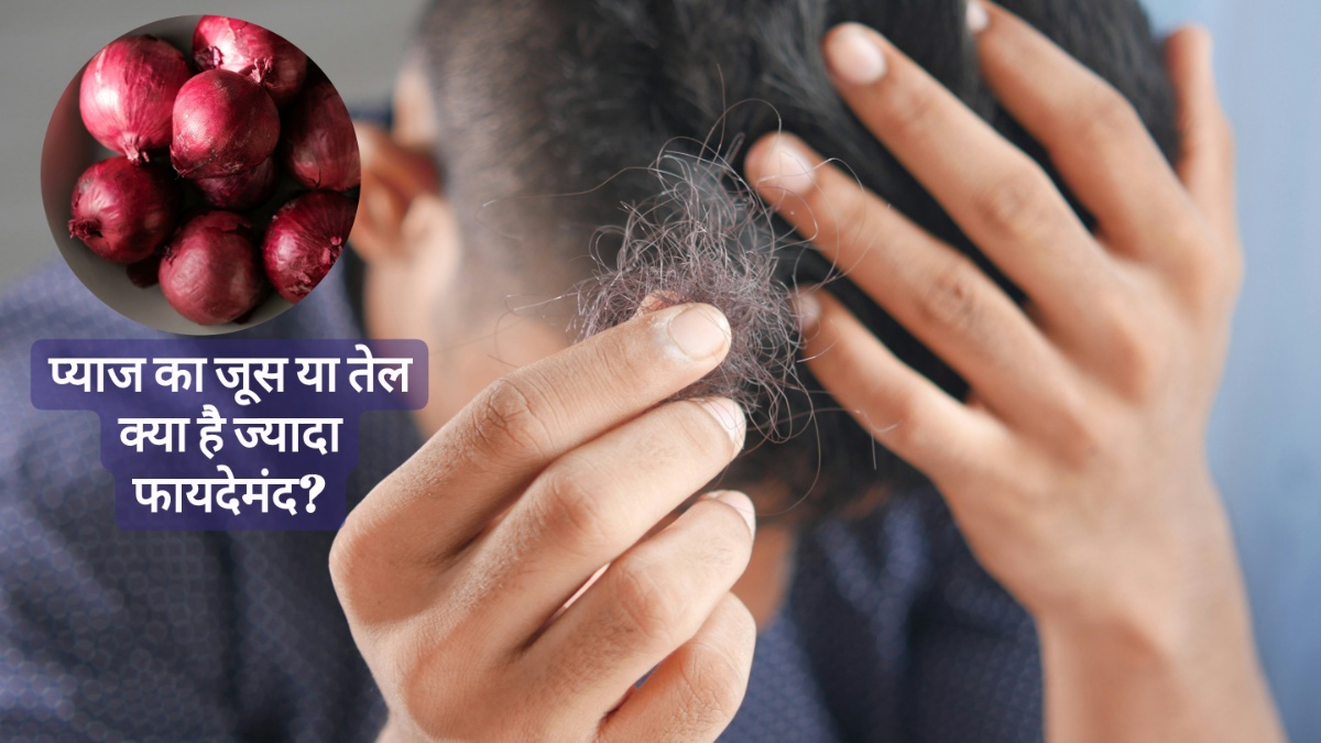 प्याज का जूस या प्याज का तेल, हेयर फॉल को कंट्रोल करने में  क्या है ज़्यादा फायदेमंद?