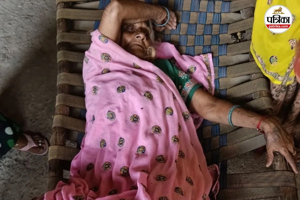 राजस्थान में दिनदहाड़े वारदात: वृद्धा के पैरों से जबरन ग्राइंडर मशीन से काटे चांदी के कड़े, पैरों में छाले पड़े