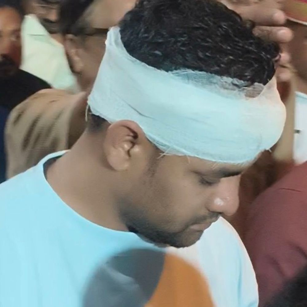 हरदोई में एसडीएम शाहाबाद पर पथराव, सिर में लगी चोट:अन्नपूर्णा भवन निरीक्षण के दौरान प्रधान प्रतिनिधि से हुई नोंकझोंक, 5 टांके लगे