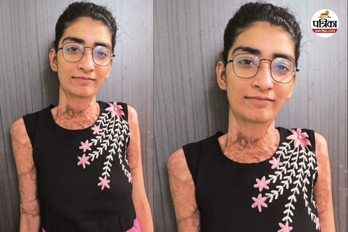 JEE Success Story: हाथों से पेन नहीं पकड़ पाती थी, फिर भी JEE में चमकी रायपुर की मनिंदर, जानें प्रेरणादायक कहानी