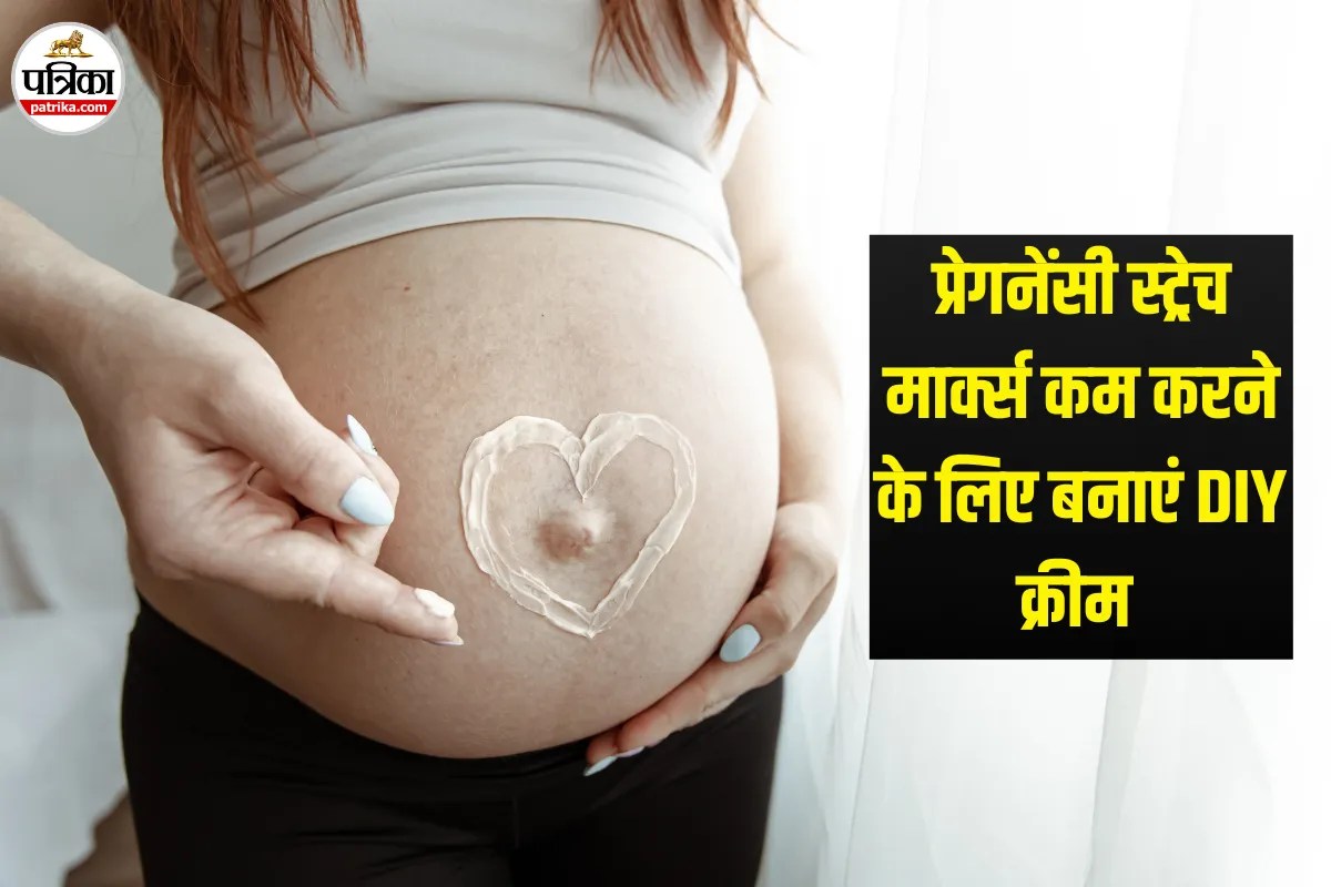 Pregnancy Stretch Marks कम करने के लिए घर पर बनाएं DIY क्रीम, गायनेकोलॉजिस्ट ने बताए आसान टिप्स