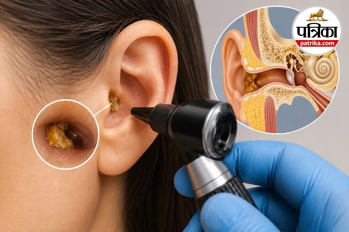 Ear Wax Signs of Disease: क्या आपके कान का मैल किसी बीमारी का संकेत है? कब सामान्य और कब डॉक्टर को दिखाना चाहिए