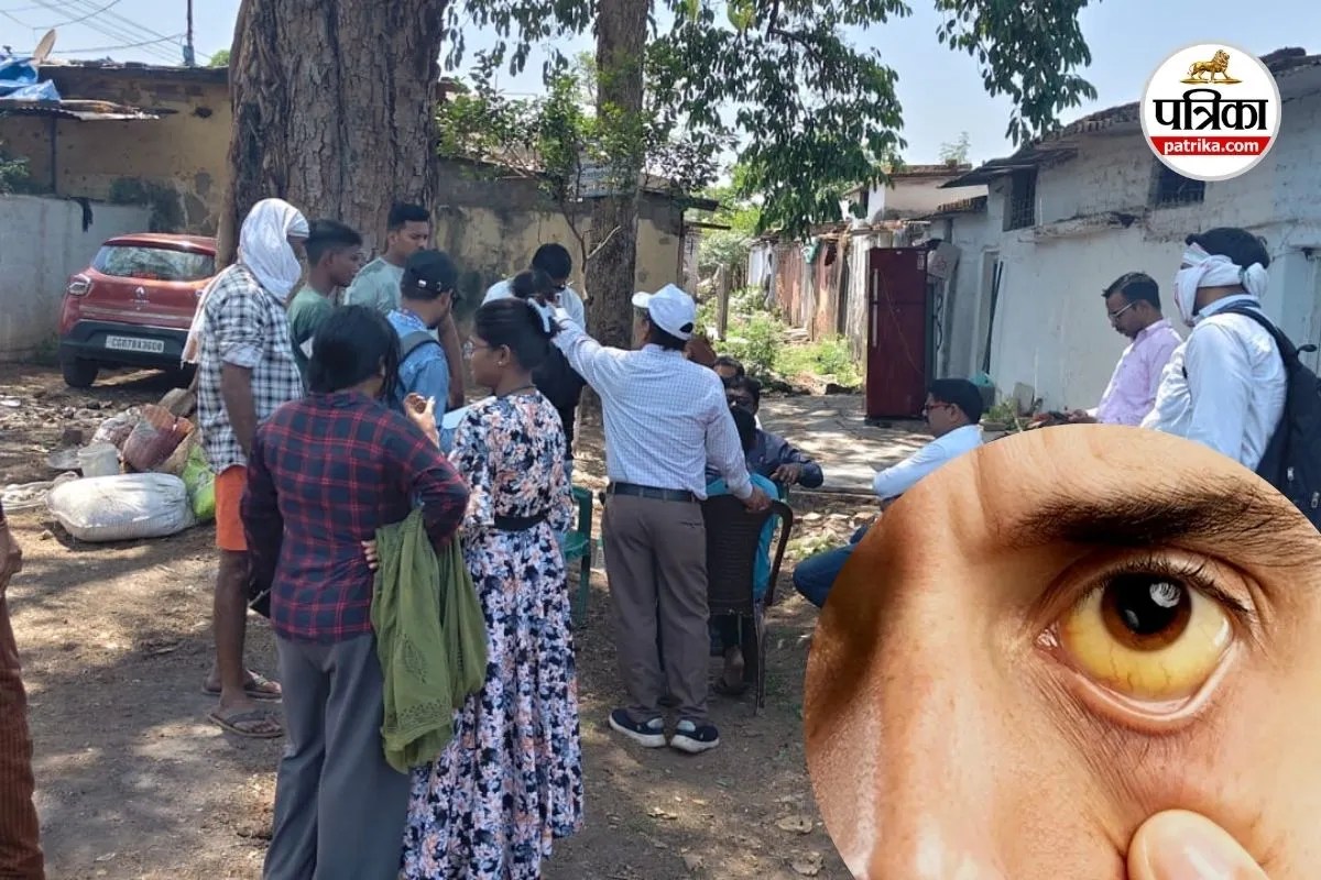 मैनपाट में पीलिया से 5 मौत की आशंका, गांवों में मचा हड़कंप, जांच में जुटा स्वास्थ्य विभाग