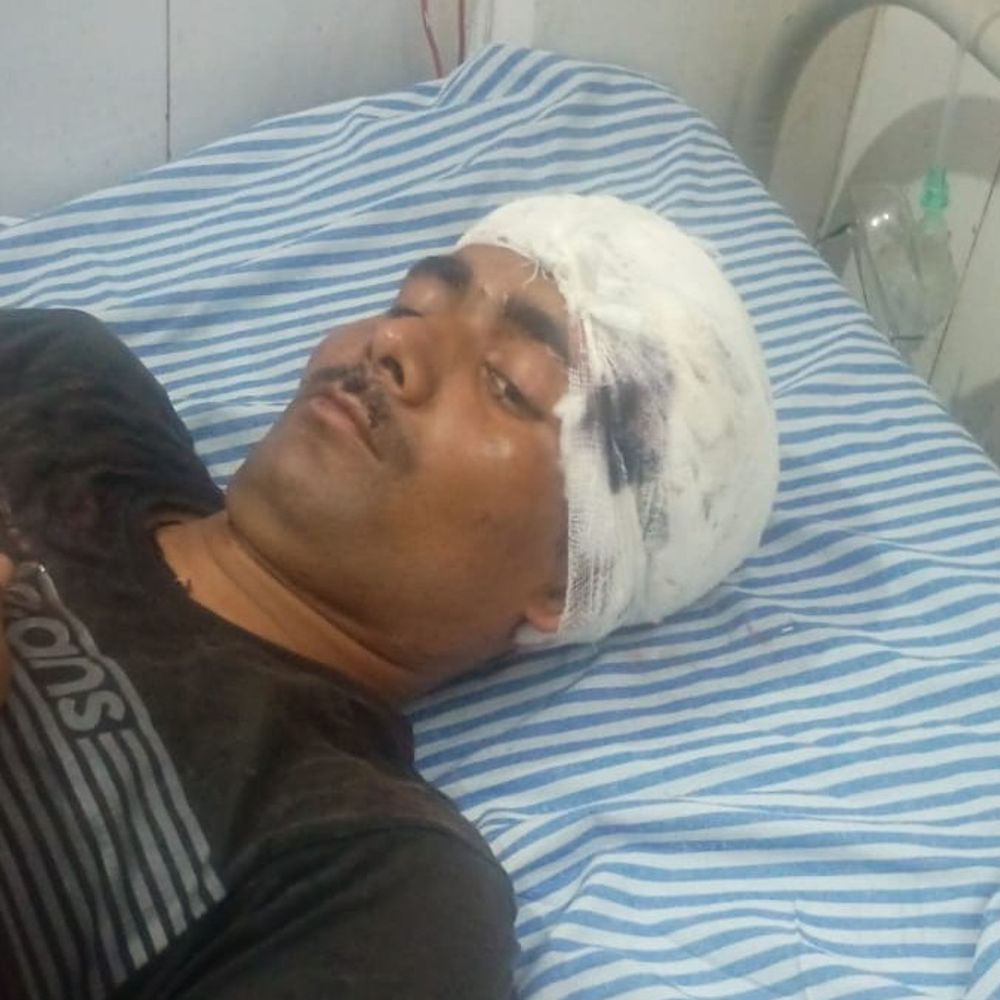 देवरिया में बंटवारे विवाद में पिता-पुत्र पर हमला:धारदार हथियार से किया हमला, बेटे की हालत गंभीर; अस्पताल में भर्ती