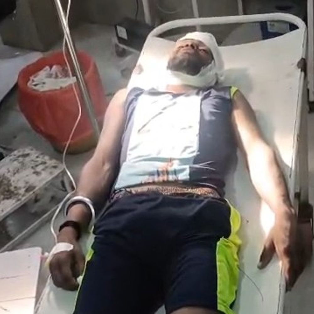 शाजापुर में वाटर पार्क में गोता लगाते युवक घायल:सिर में चोट लगी, गंभीर हालत में इंदौर रेफर