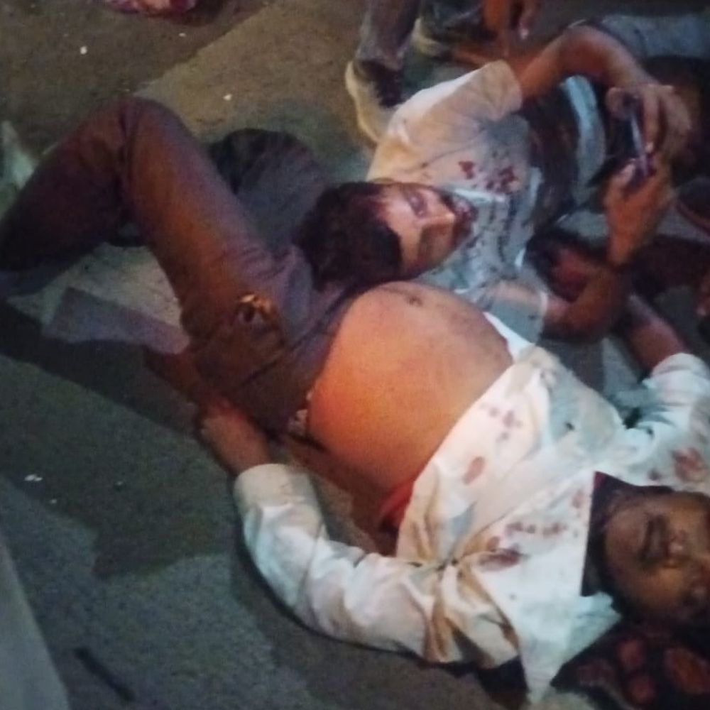 मजदूरों से भरी बस ट्रक से टकराई, 1 की मौत:शाजापुर में NH-52 पर हादसा, 18 घायल; अवैध लकड़ी परिवहन पर उठे सवाल