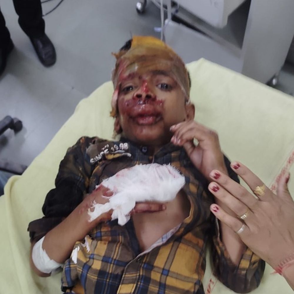 नारनौल में NH-148 B पर हुआ सड़क हादसा:कार ड्राइवर ने मारी सड़क पर खड़े लोगों को टक्कर, राजस्थान की दो महिलाओं की मौत