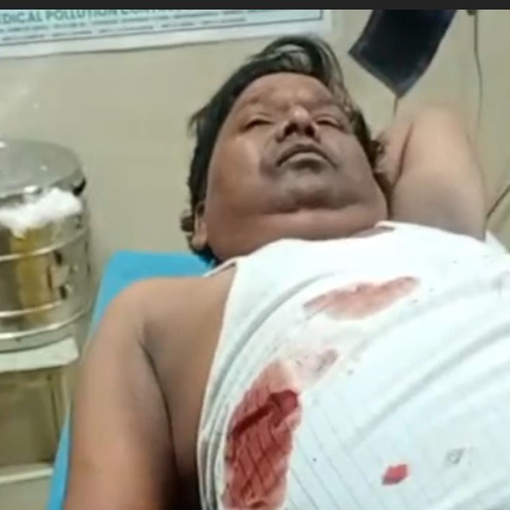 स्कूल में बंदर घुसा, टीचर को काटकर किया घायल:देवरिया में कॉपी जांचते समय दाहिने हाथ में काटा, लहुलुहान हालत में अस्पताल भर्ती