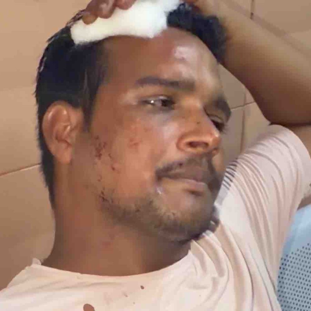 पटाखा पैरों में डालने को लेकर दो पक्ष भिड़े:रामपुर में विवाद बढ़ा, मारपीट में युवक घायल; सिर में चोट आई