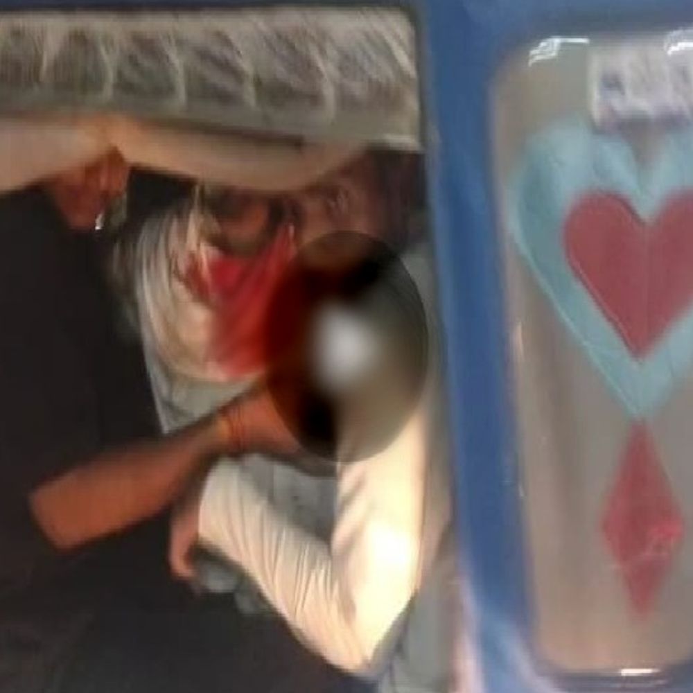 हॉर्न बजाने पर पड़ोसी ने कार से 2 बार कुचला:ग्वालियर में पहले टक्कर मारी, फिर बैक कर दोबारा चढ़ाई कार; आरोपी गिरफ्तार