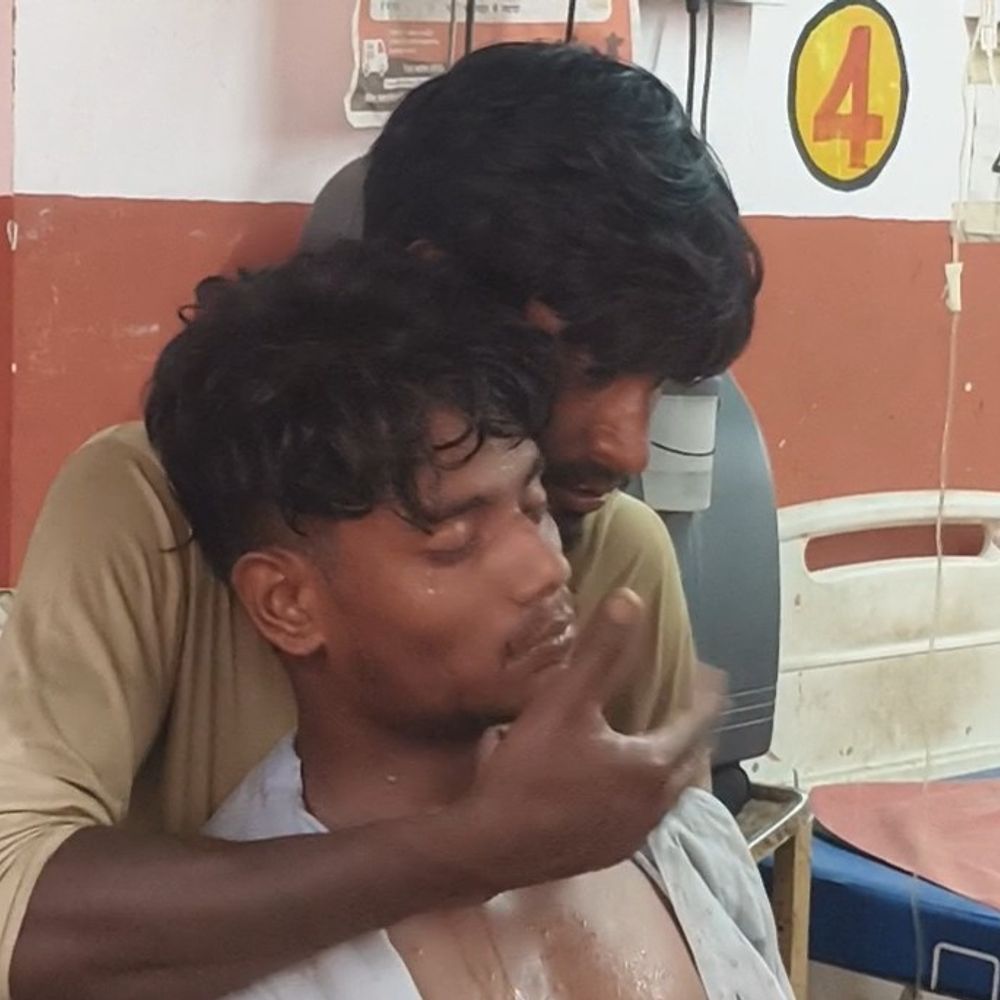 सांप के डसे युवक को भाई ने जड़े 150 थप्पड़:डॉक्टर की सलाह पर 15 एंटी-वेनम डोज से बची जान