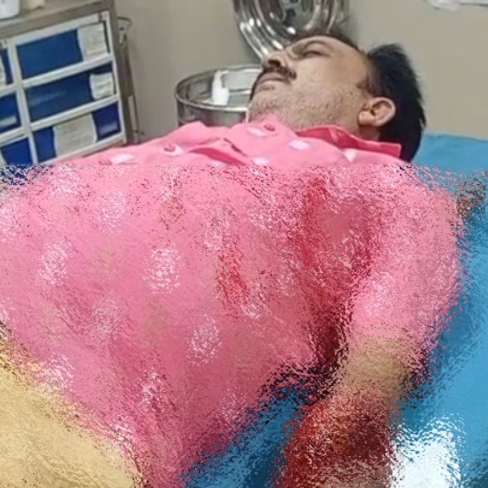 देवरिया में दो बसों के बीच फंसा यात्री का हाथ:उतरते समय चपेट में आया, गंभीर हालत में गोरखपुर रेफर