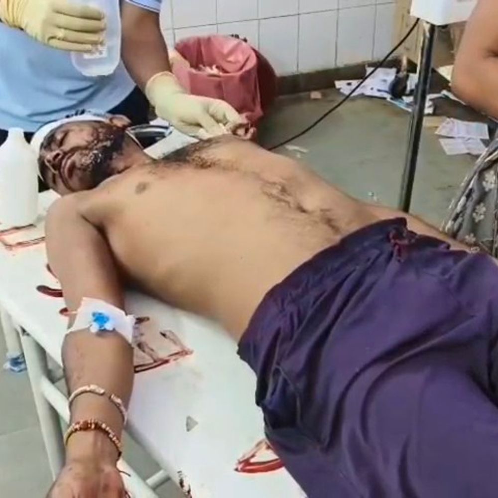 धारदार हथियार से युवक पर हमला:रास्ते में घेरकर किए वार, बाइक से लौट रहा था घर, गंभीर हालत में इलाज जारी