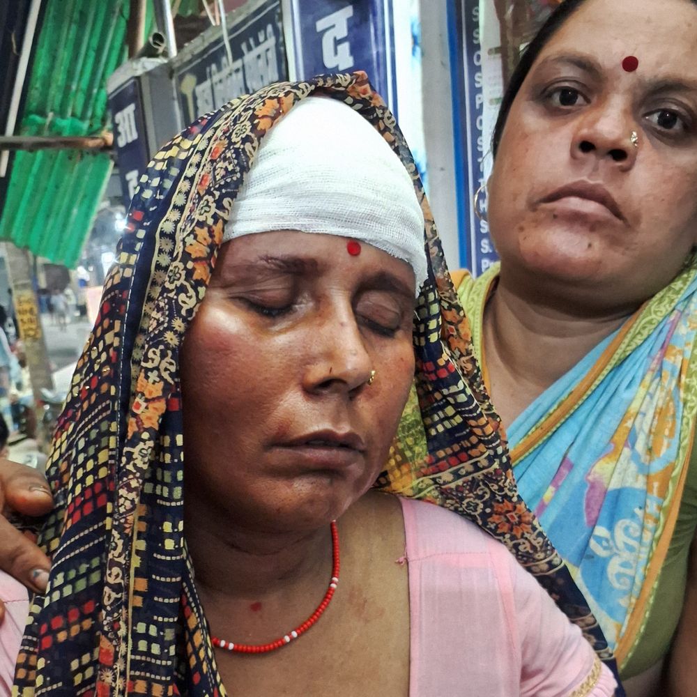 नारायणपुर में पिकअप ने ई-रिक्शा को टक्कर मारी:3 लोग गंभीर घायल, अस्पताल में भर्ती; NH-31 पर हादसा