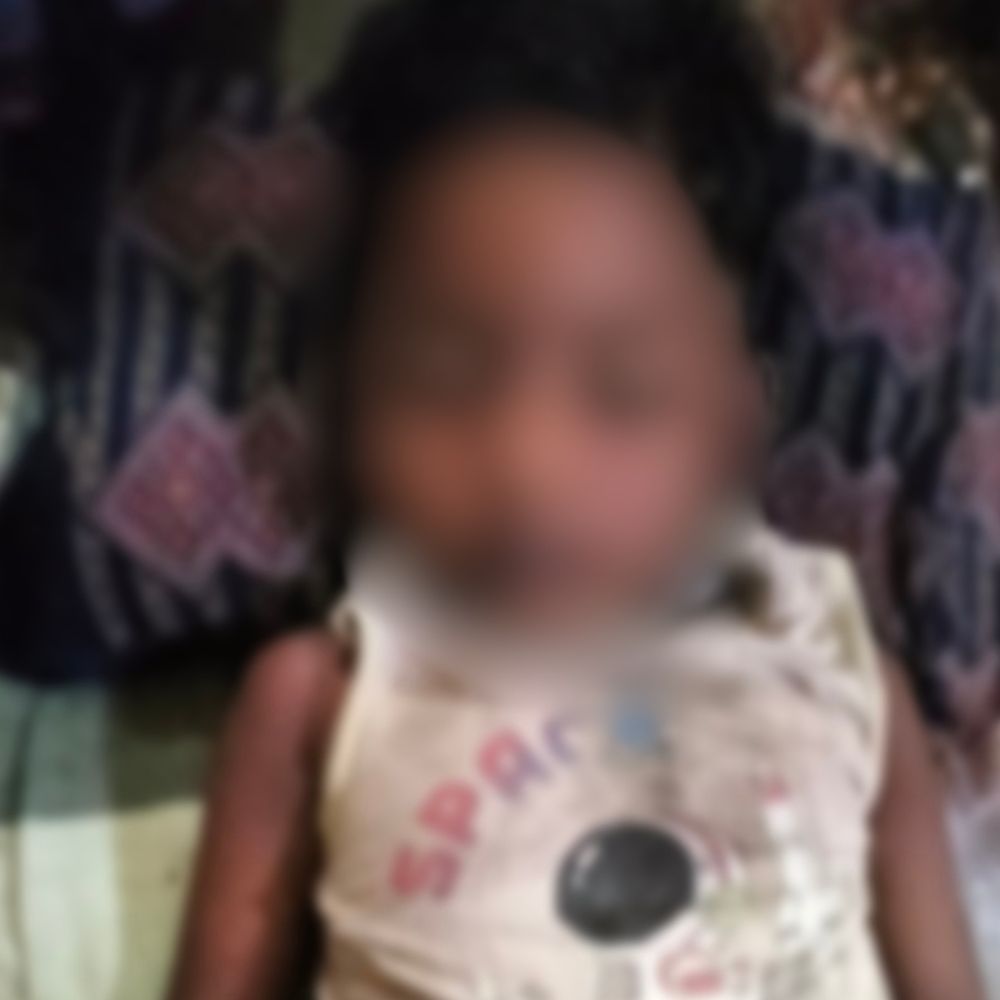 बेगूसराय में सर्पदंश से चार वर्षीय बच्चे की मौत:घर के पास खेलते समय सांप ने डंसा, अस्पताल ले जाते वक्त तोड़ा दम