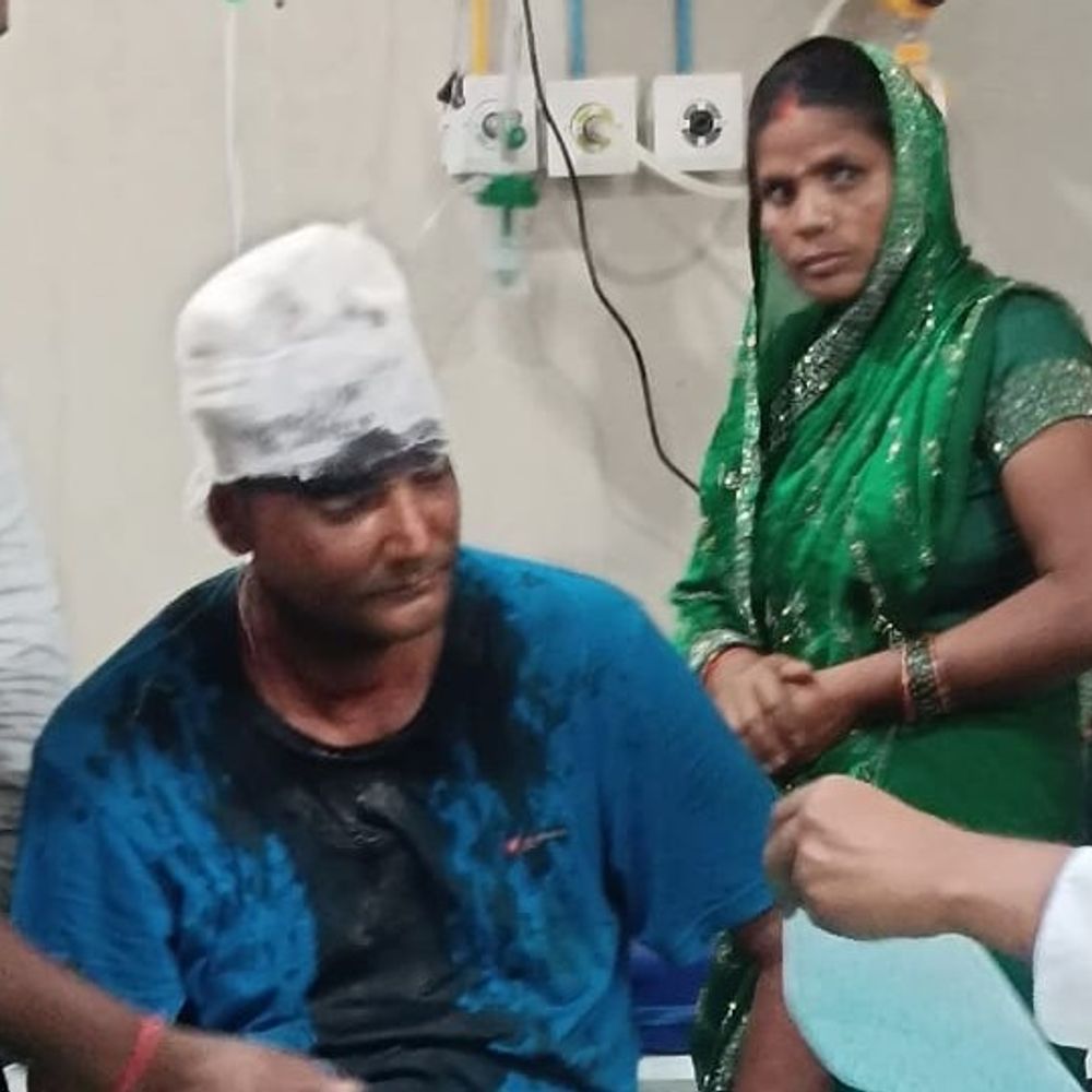 देवरिया में ढाबे के पास दो युवकों पर हमला:5 बाइक सवारों पर रॉड और धारदार हथियार से वार का आरोप